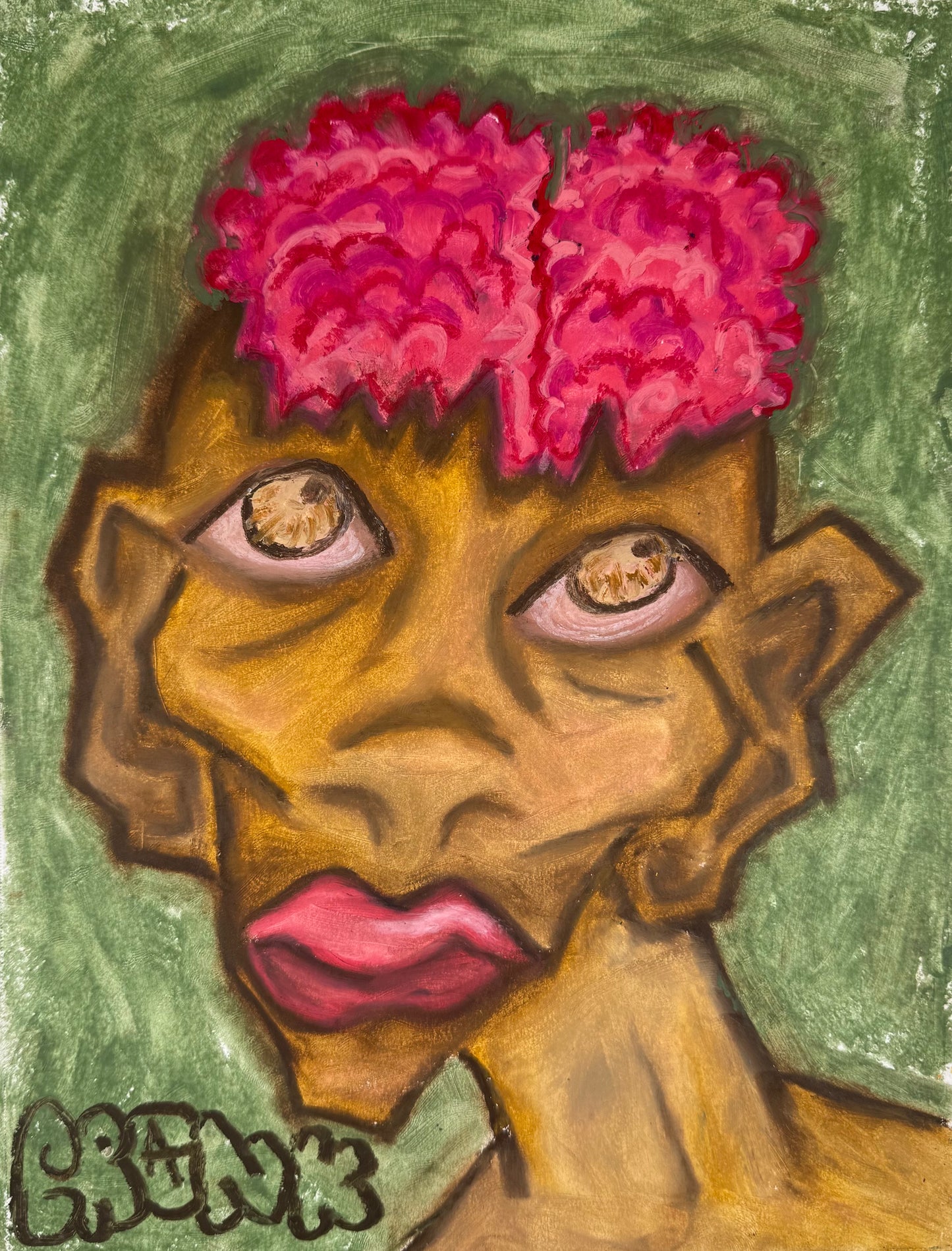 "Migraine"